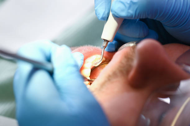 Best Broken Tooth Emergency  in Thomasboro, IL
