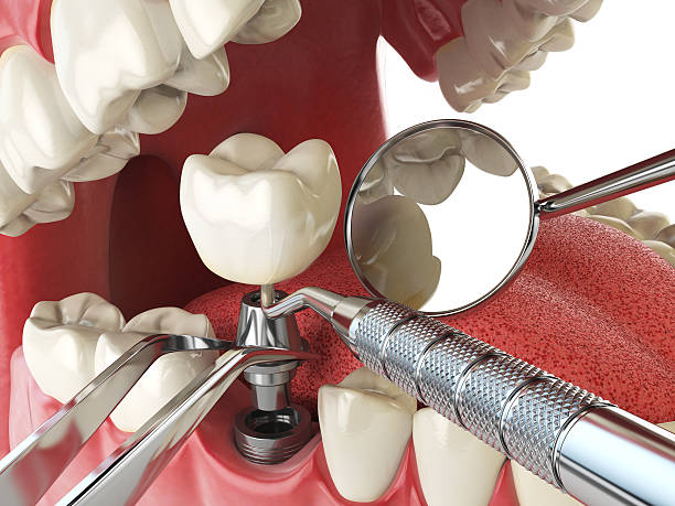 Best Root Canal Emergency Dentist  in Thomasboro, IL